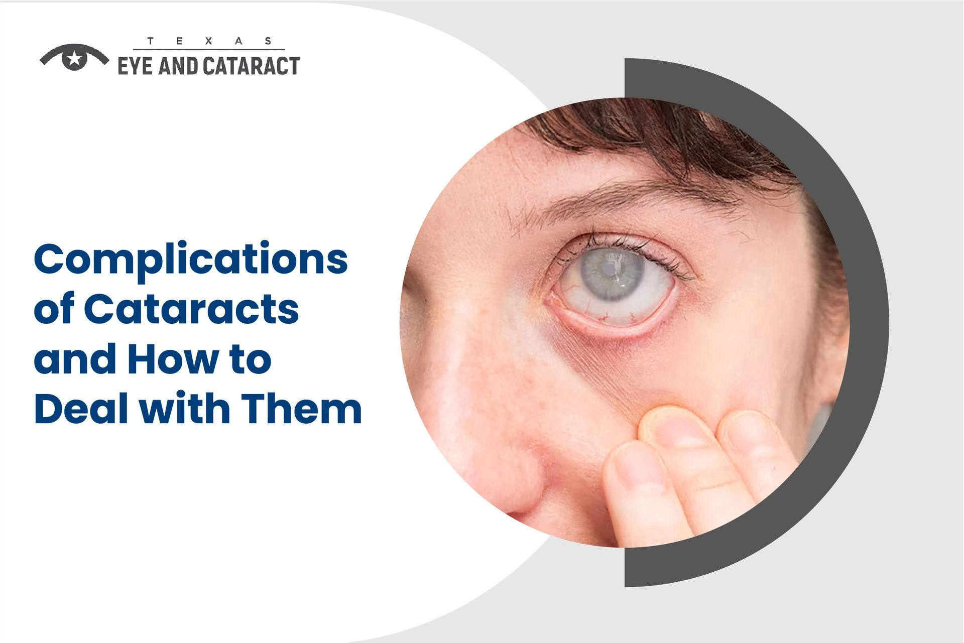 Possible complications and risks of cataract surgery