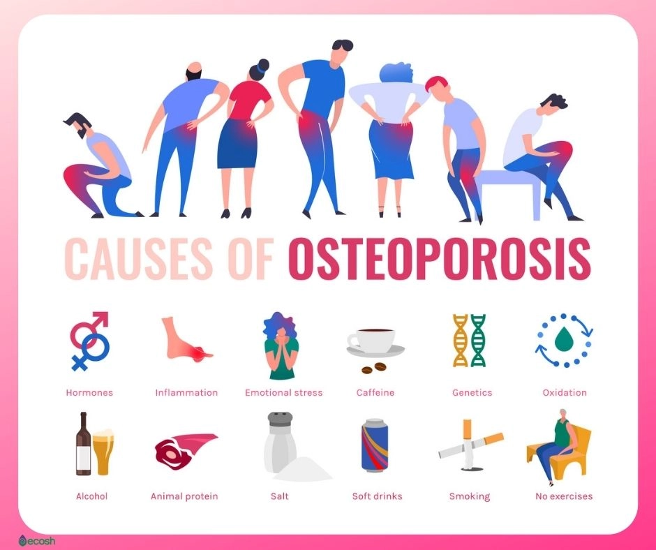 Risk Factors for Osteoporosis in Young Adults