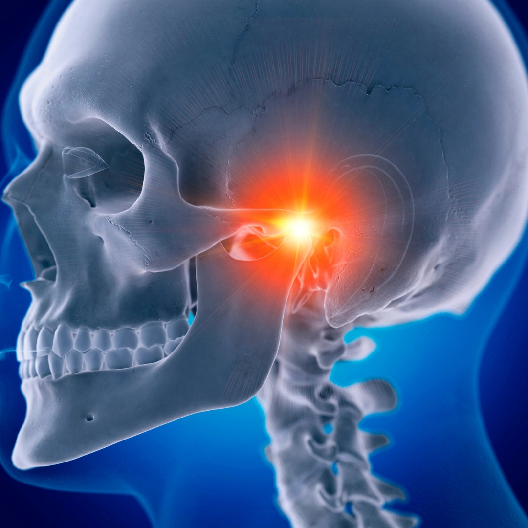 Common Causes of Temporomandibular Joint Disorders