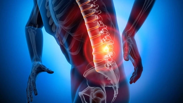 Common symptoms of a herniated disc in the lower back