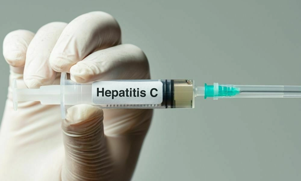 Prevention strategies for Hepatitis C, including vaccination and safe sex practices