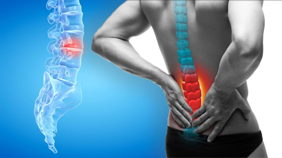 Treatment options for a herniated disc in the lower back