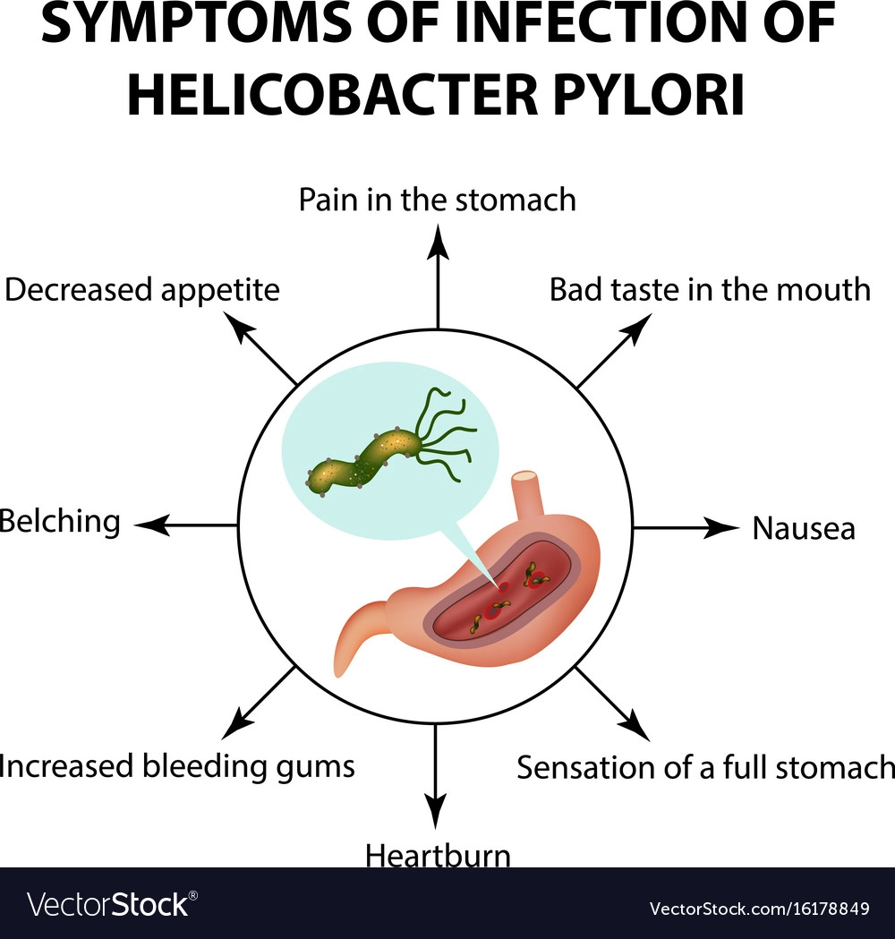 Common symptoms of Helicobacter pylori infection