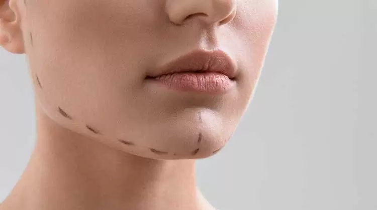 How does lip augmentation work and what are the different types of lip fillers available?