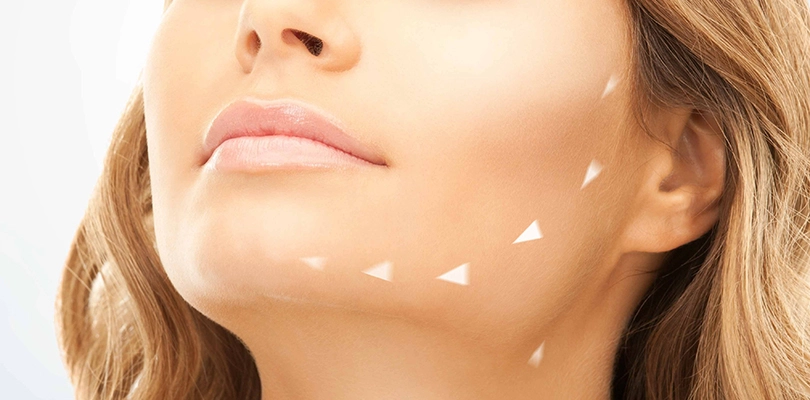What are the different types of chin surgery for improving facial harmony?