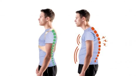 Causes of Postural Dysfunction
