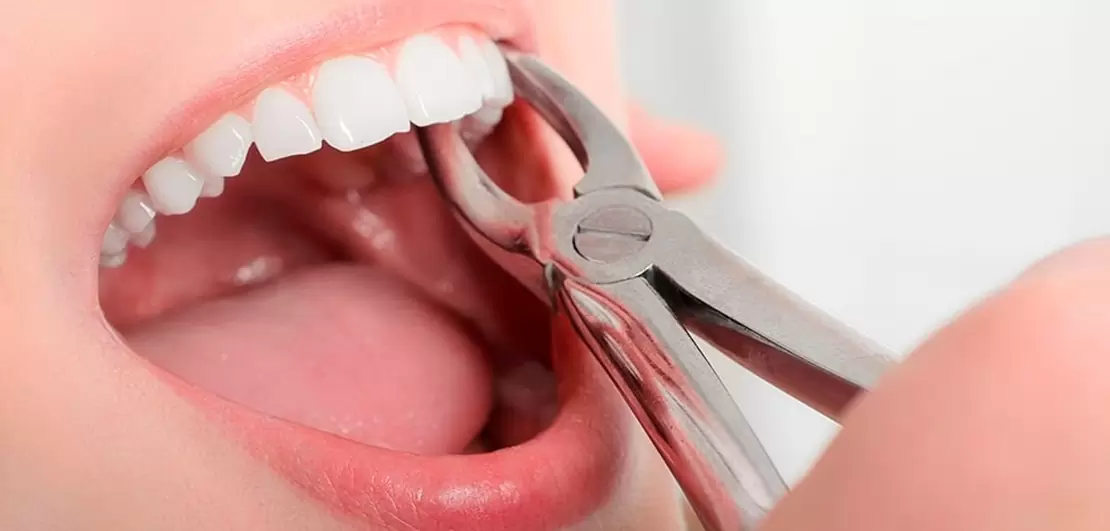 Proper brushing and flossing techniques for wisdom teeth