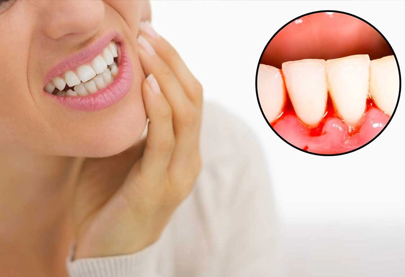 Causes and Symptoms of Dental Root Infection