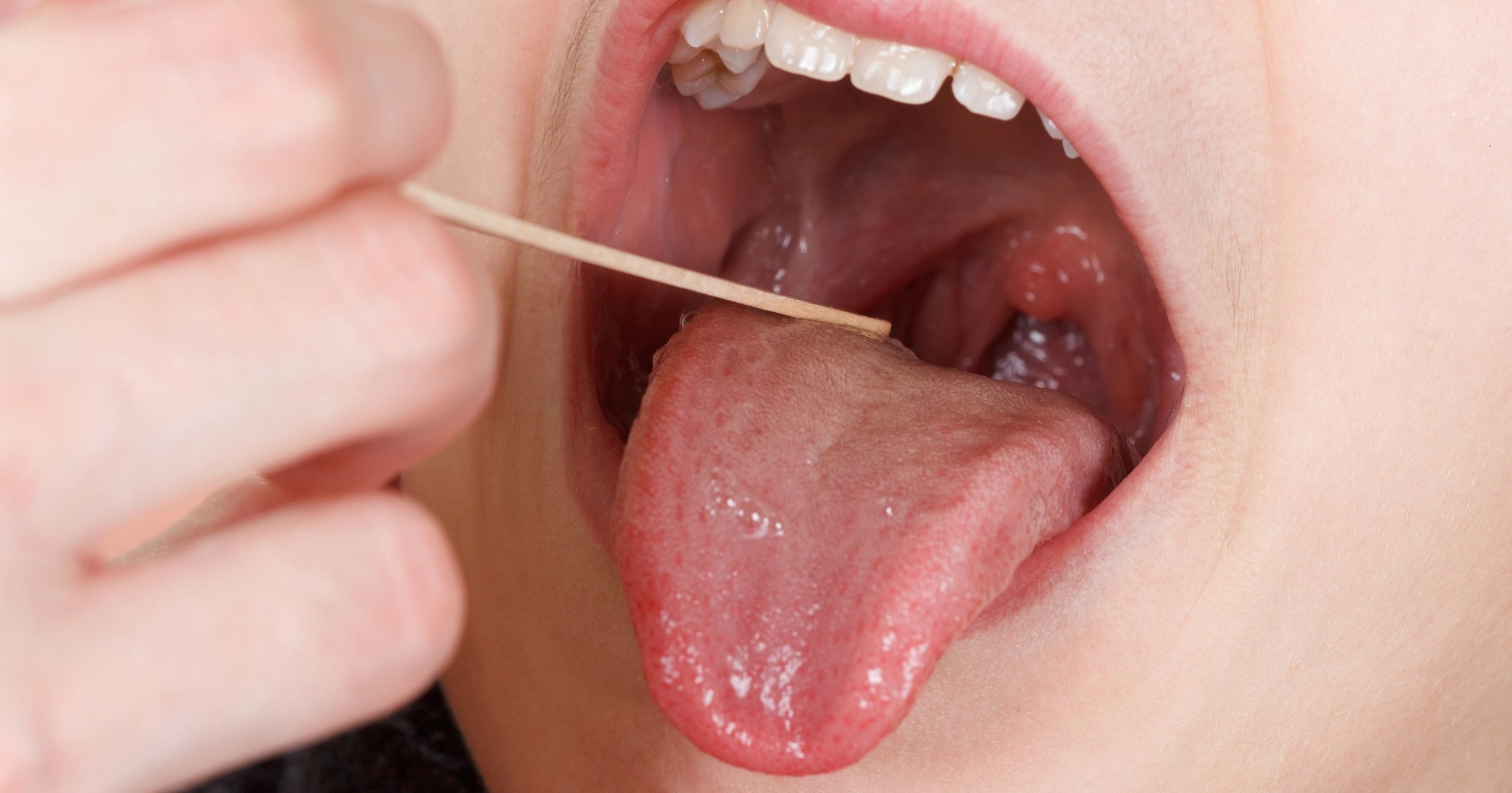 Common Symptoms of Oral Cancer to Look Out For