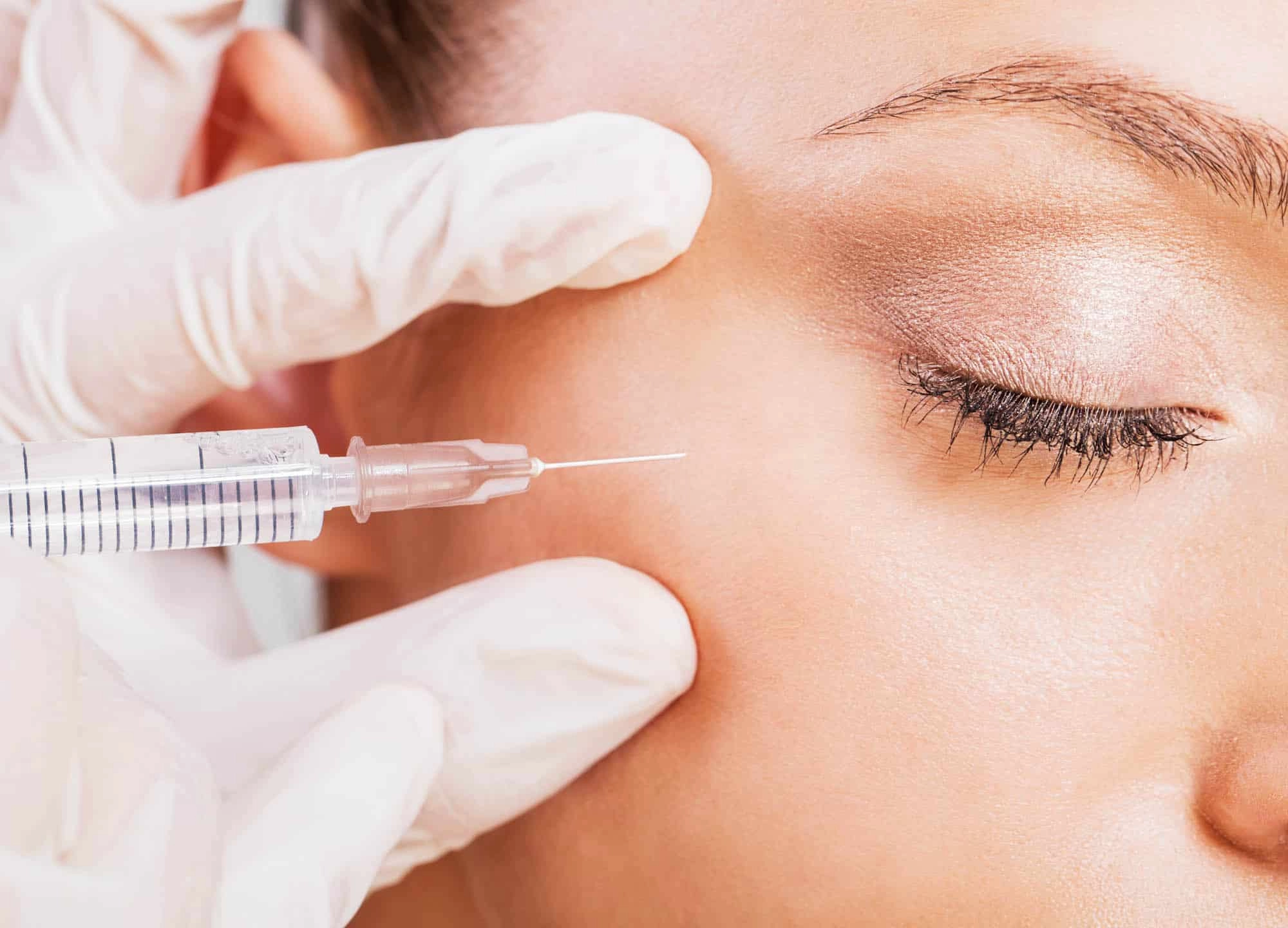 What are the potential risks and side effects of under eye filler injections?