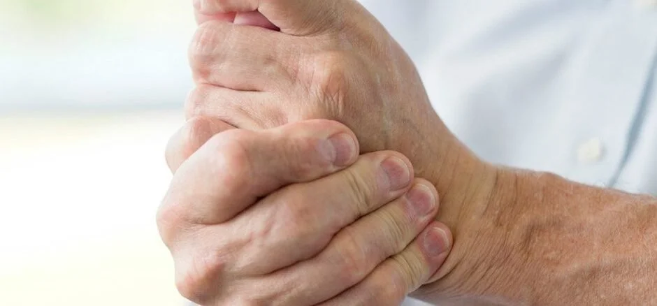 Hand Arthritis and Related Conditions