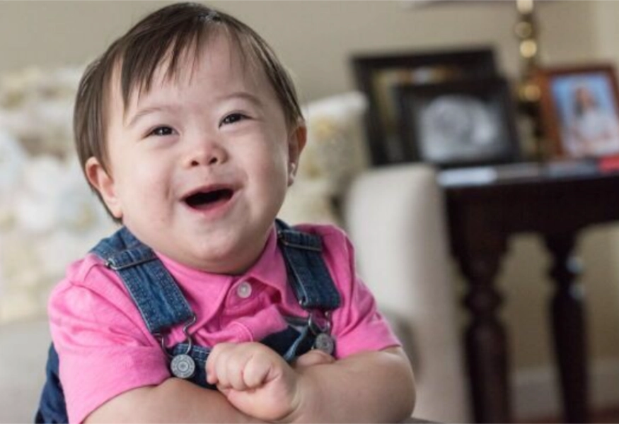 Understanding Down Syndrome and Its Causes