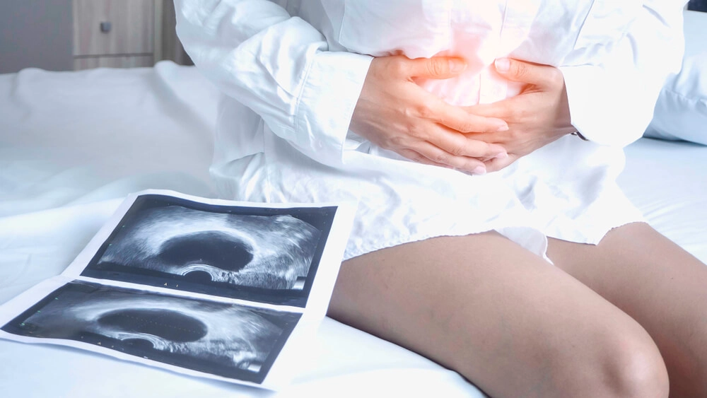 Treatment Options for Ovarian Cysts